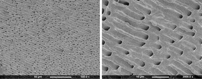 Resin tags formation by modified Renewal MI formulations in a carious dentine model